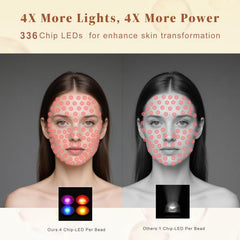 Anpor four-color therapy modes tailor treatments to your needs.