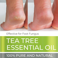 Being Naturals Tea Tree Oil bottle with purity-focused label detail.