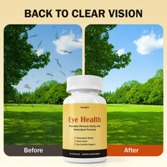 Besgiful blend nourishes eye structure with grape seed and vitamin C for resilience.
