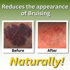 Brookethorne Relief Arnica Cream being spread for a smooth massage glide.
