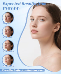 EVFOFO wireless design image emphasizing cordless freedom during treatment.