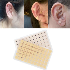 Hedigon auricular stickers close-up: high-quality ear seeds for precise placement.