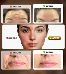 Holsn device enhances face-cream absorption to boost results