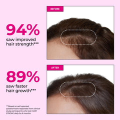 HUM Hair Strong bottle side label shows biotin, zinc, and B vitamins