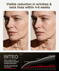 INTEO four-modes LED setup with infrared, red, orange and blue wavelengths