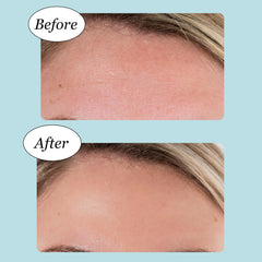 Jane Vine forehead patches on forehead provide comfortable, non-slip wear.