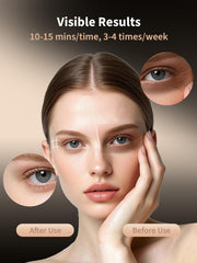 LightinMax eye mask with two eye protectors supports gentle, targeted care