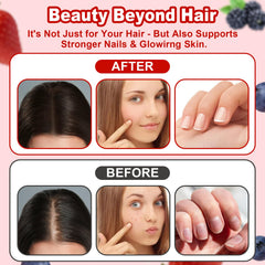 LUIMOLL Lumin Hair Growth Gummies mixed berry flavor displayed for a tasty daily ritual.