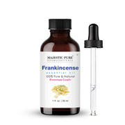 Majestic Pure frankincense oil bottle for diffusion and aromatherapy use.