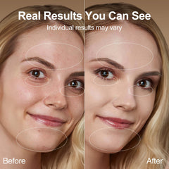 NeatLt vibration massage head applying on skin for soothing care