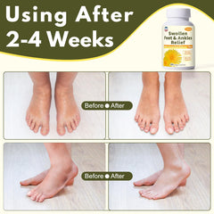 Netrca Swollen Feet bottle label highlights natural ingredients including dandelion.
