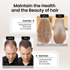 NiceTop Hair Growth ingredients label shows vitamins and minerals