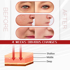SJFEHLLD seven-color LED face mask offers versatile options for smooth-looking skin.