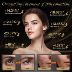 SUPDESIR 4D curved facial fit silicone shell ensures comfortable coverage