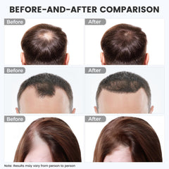 WEETALL red light hair cap showing rechargeable battery for movement