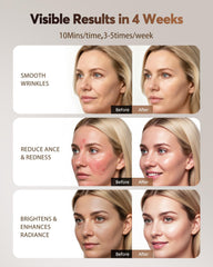 XSSNVV led mask amber light 580nm for brightening routines