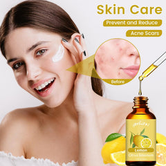 Yethious lemon essential oil for skin care and complexion support.