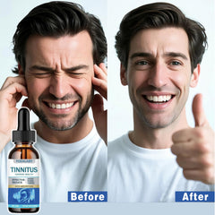 YOEALABY tinnitus relief drops application shows convenient daily use.