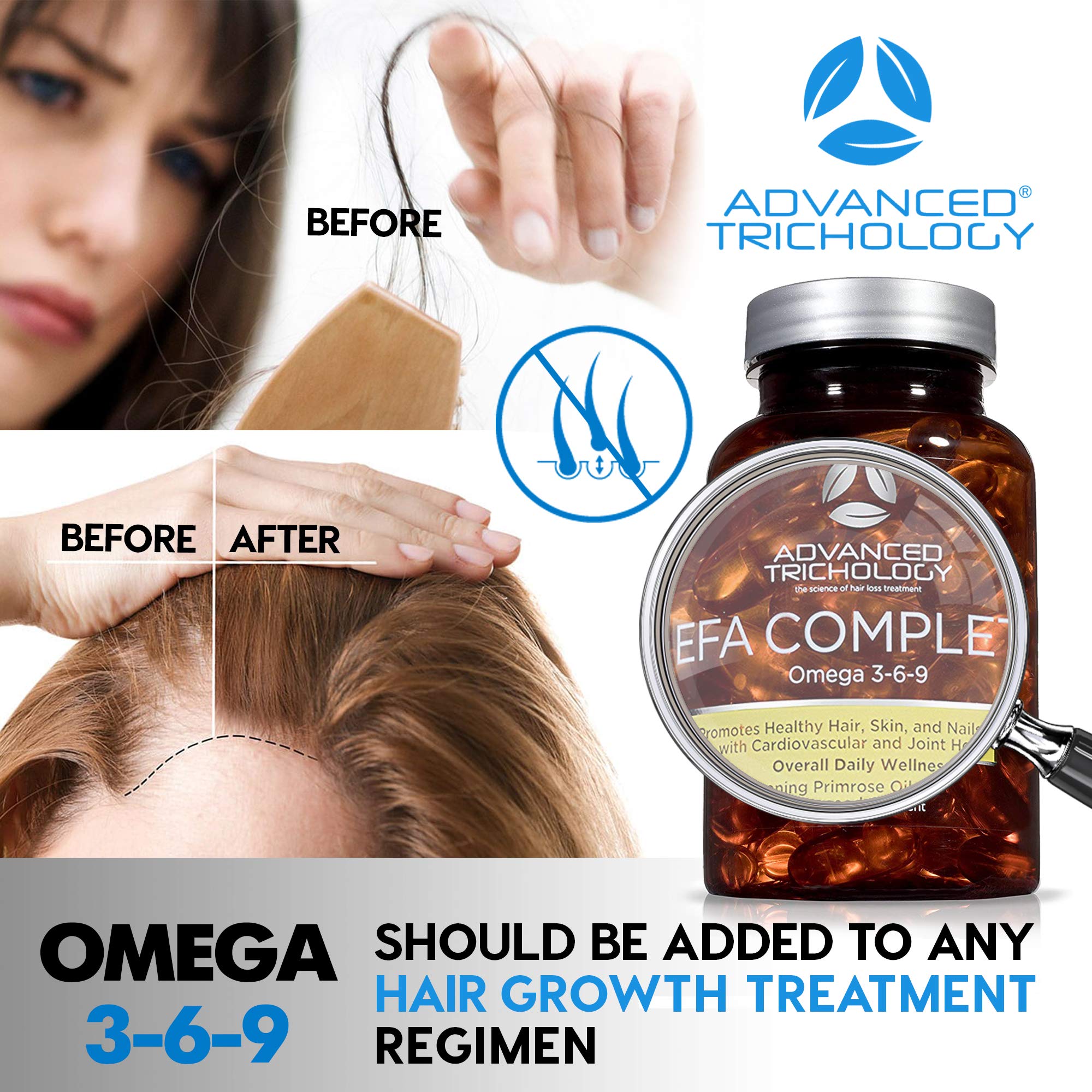 Advanced Trichology EFA Complete – Optimal Omega 3 6 9 Blend (800 mg, 90 capsules) – 3rd Party Tested