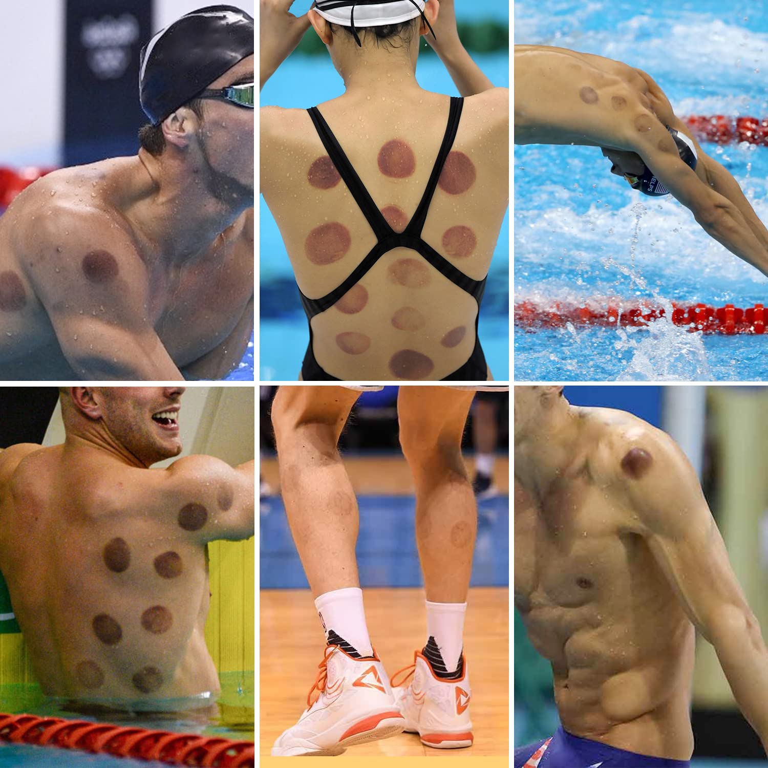 AIKOTOO cupping set gua sha tool complements therapy sessions.