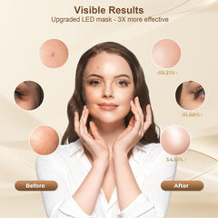 AIUO ergonomic silicone mask for a skin-friendly, comfortable fit