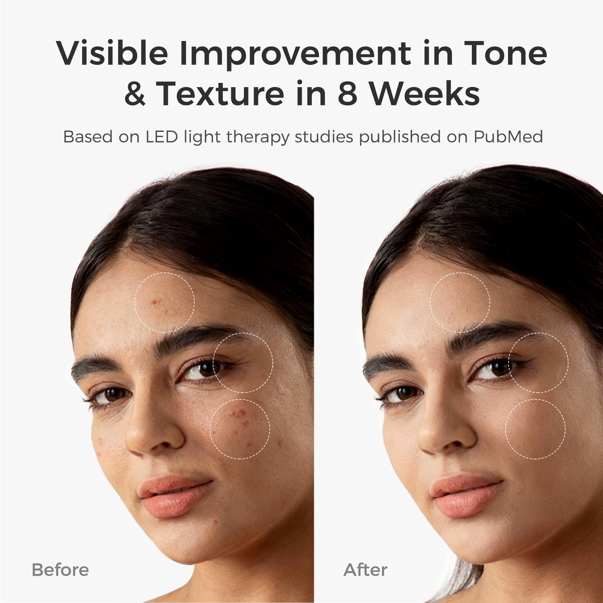 ARIVEA mask showing 3-wavelength modes: red, blue and infrared for customizable sessions.