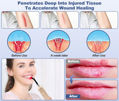 Aswaysun red light therapy wand for knee and joints supporting mobility.