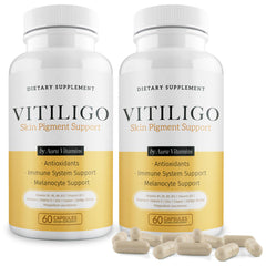 Aura Vitamins Dermawonder Vitiligo Capsules bottle with label, convenient daily skin pigment support.