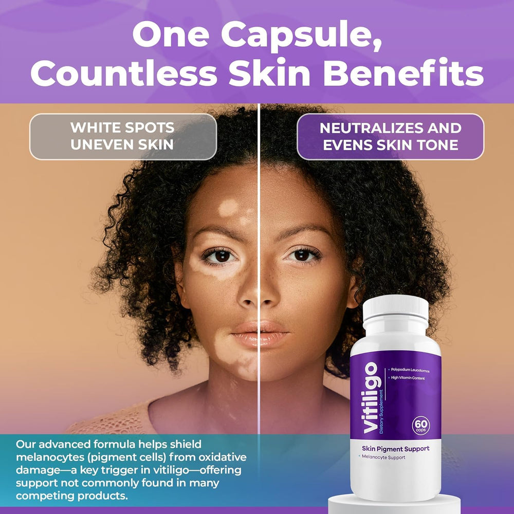 Aura Vitamins Vitiligo Capsules label close-up showing ingredients list