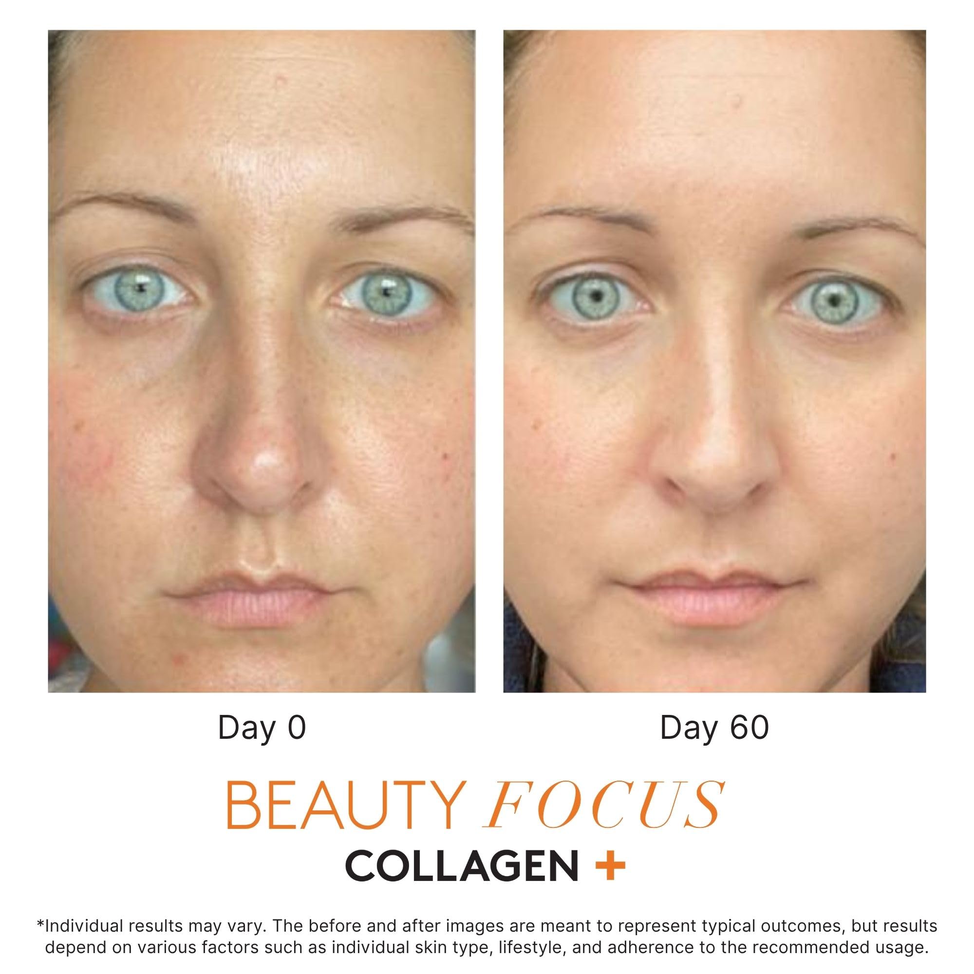 Beauty Focus acerola cherry close-up highlighting a natural vitamin C source.
