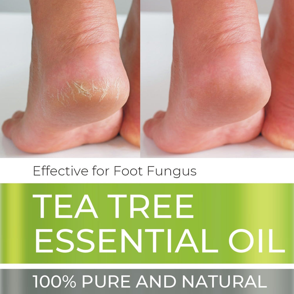 Being Naturals Tea Tree Oil bottle with purity-focused label detail.