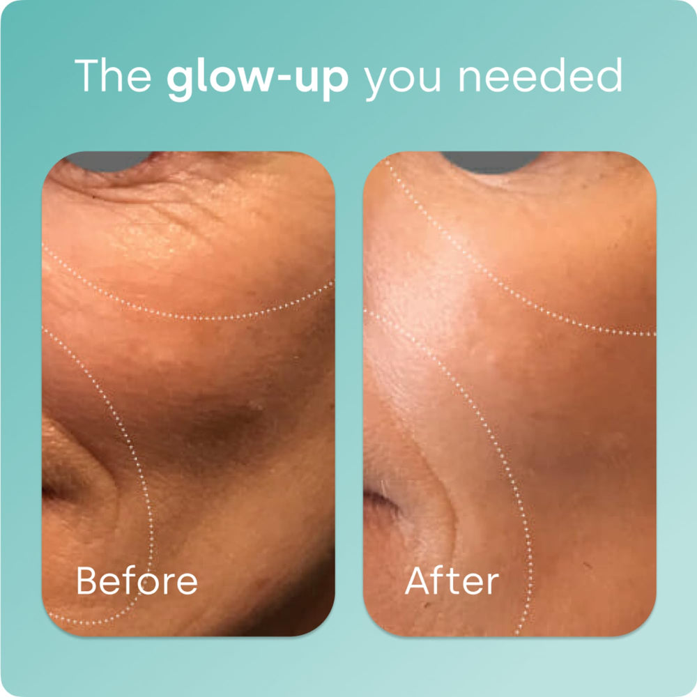 BioSil skin glow close-up suggests potential radiance from collagen support.