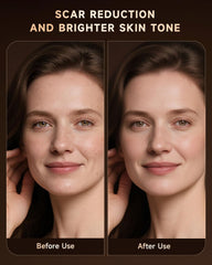 BMONATY mask demonstrates full-body spot treatment versatility for neck, hands, or chest.