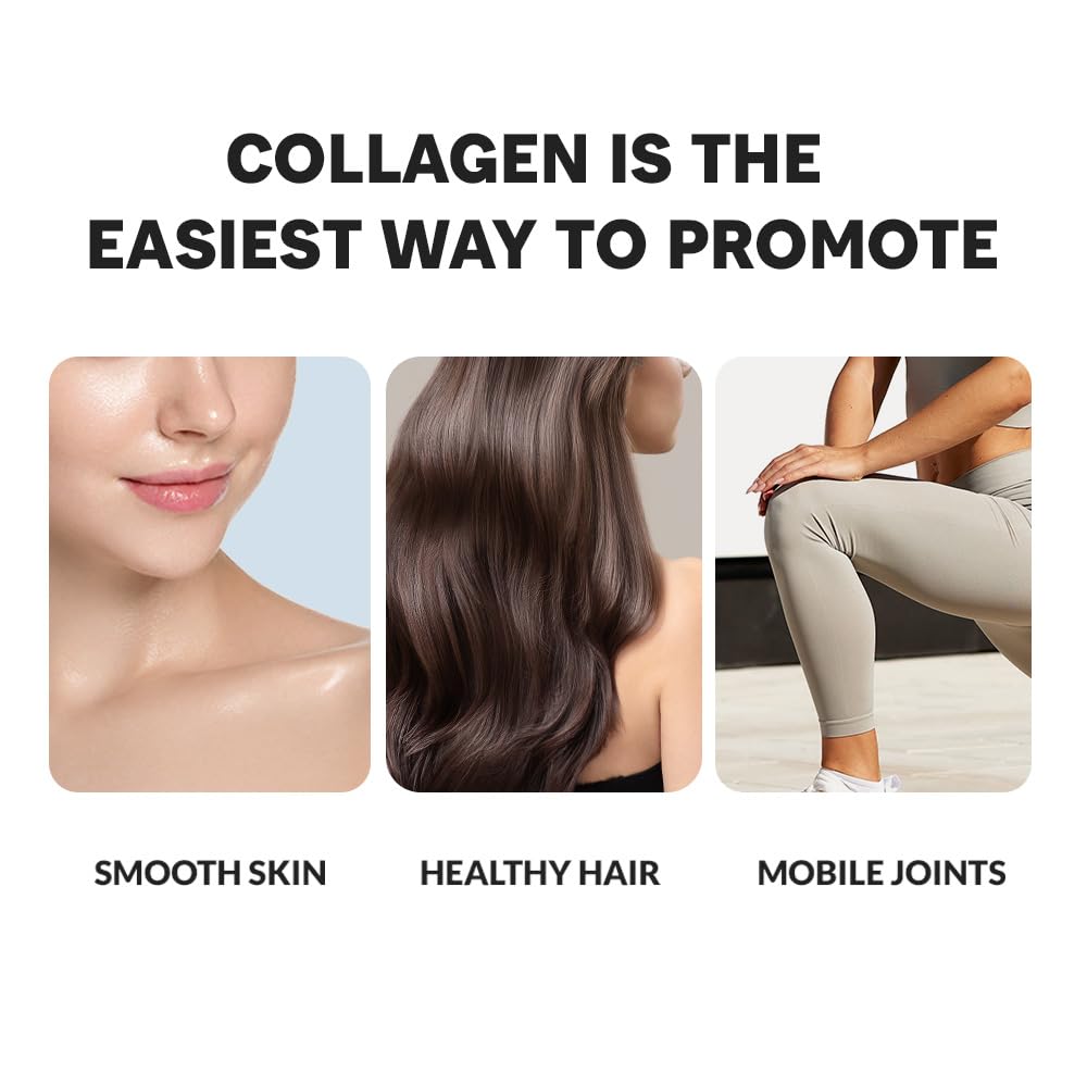 Cevitol collagen for joints illustrating mobility support potential