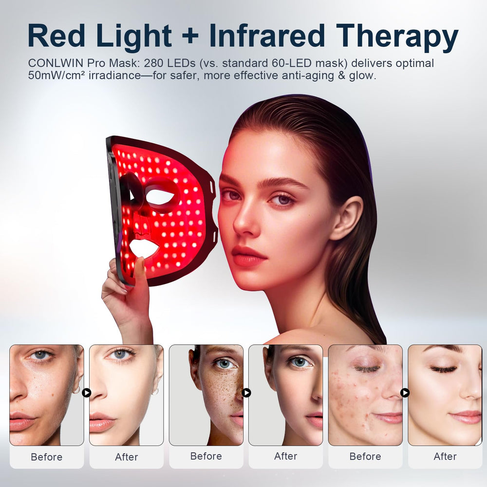CONLWIN eight-color therapy blends red, NIR, and blue wavelengths for balanced tone