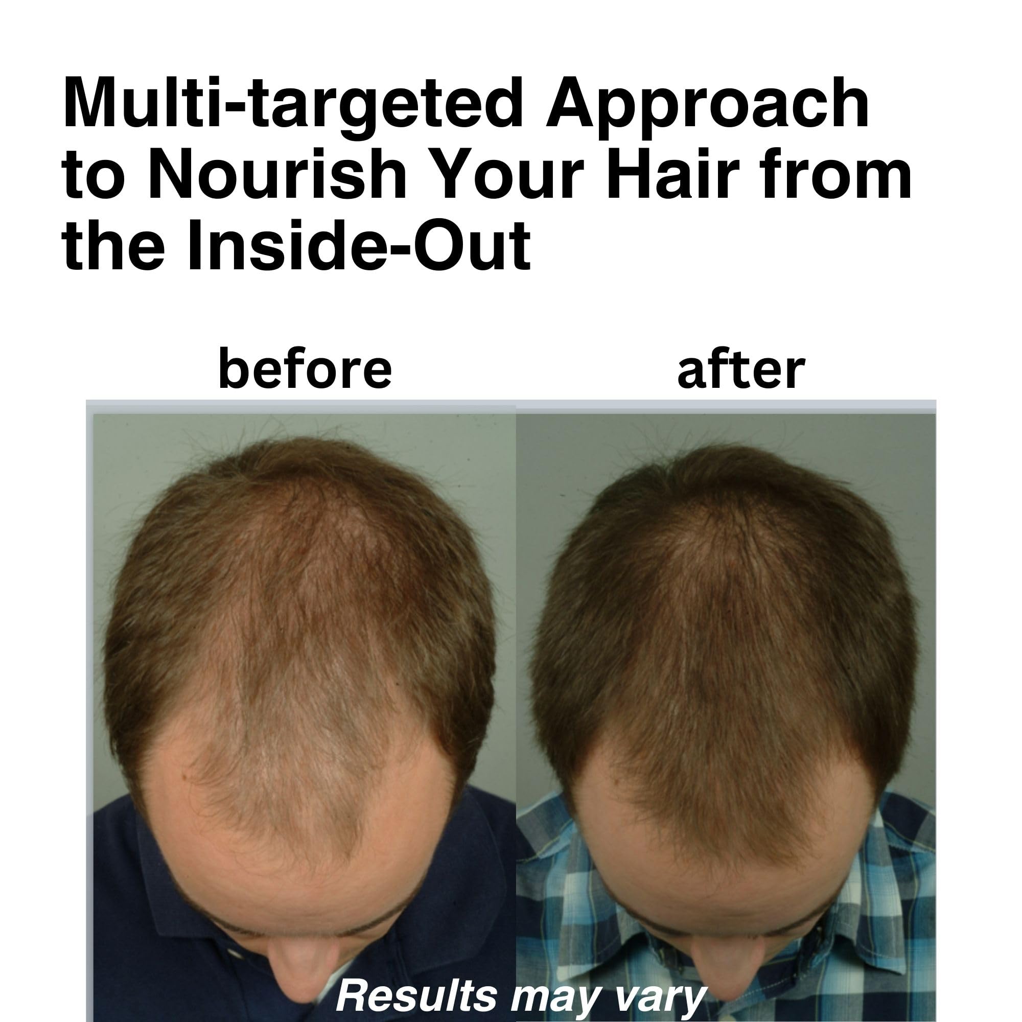 DrSG DHT Blocker capsules promoting fuller-looking hair