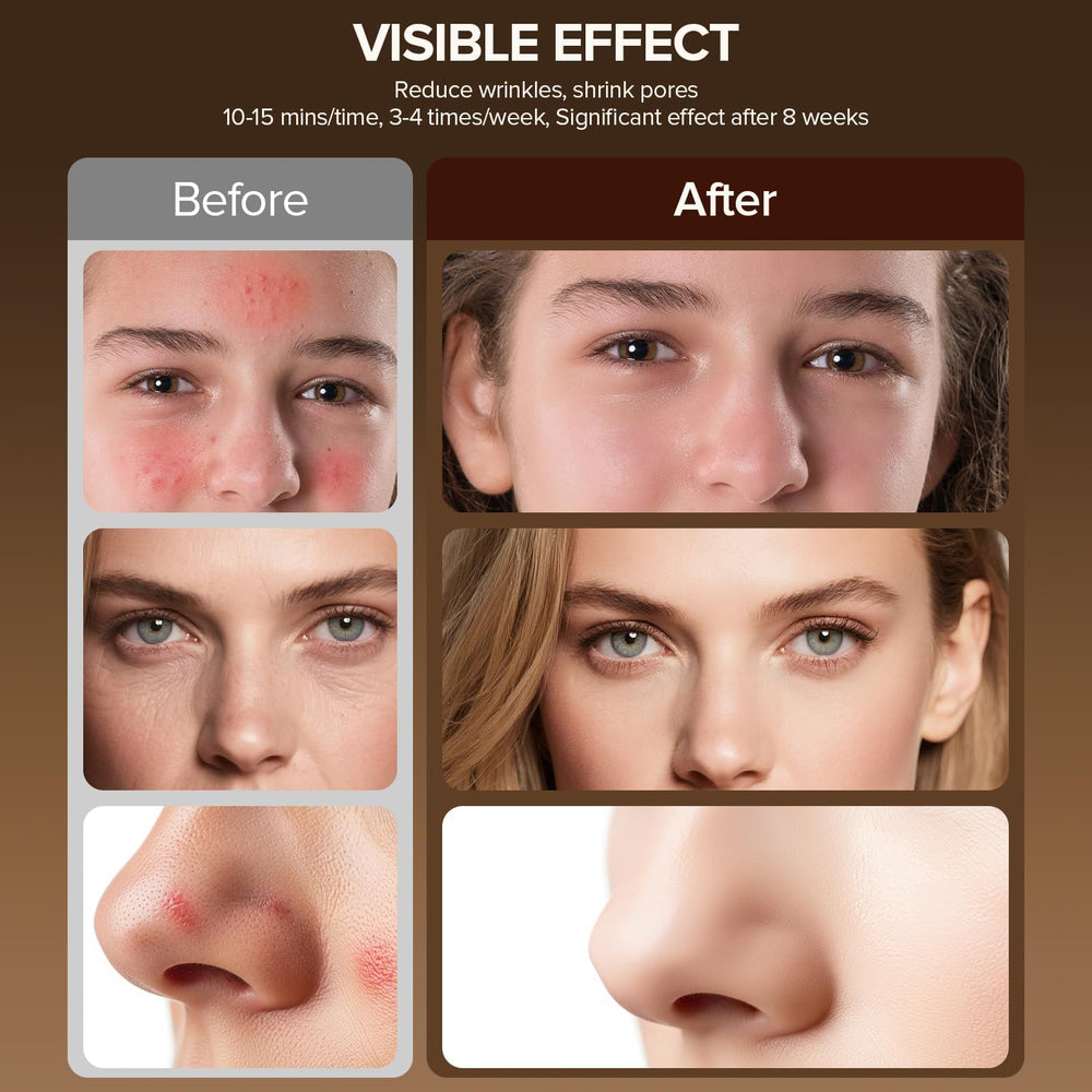Duuckin LED face mask remote control close-up for cordless operation
