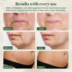 Eden and Elm full body lymphatic drainage massager for smoother skin and circulation.