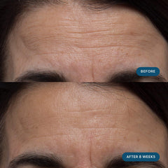 ELEMIS Pro-Collagen Skin Future capsules ready for daily use