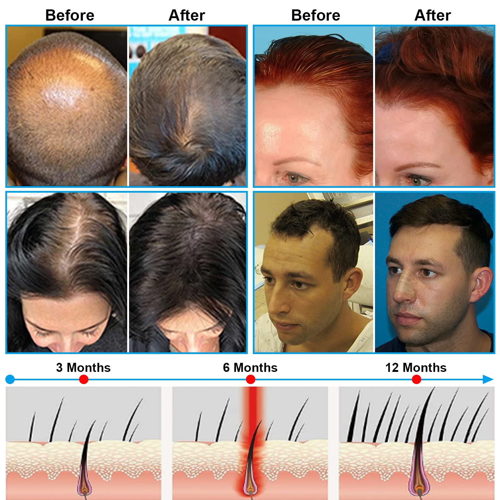 Ertiydny 20‑minute timer interface for simple, time‑planned sessions.