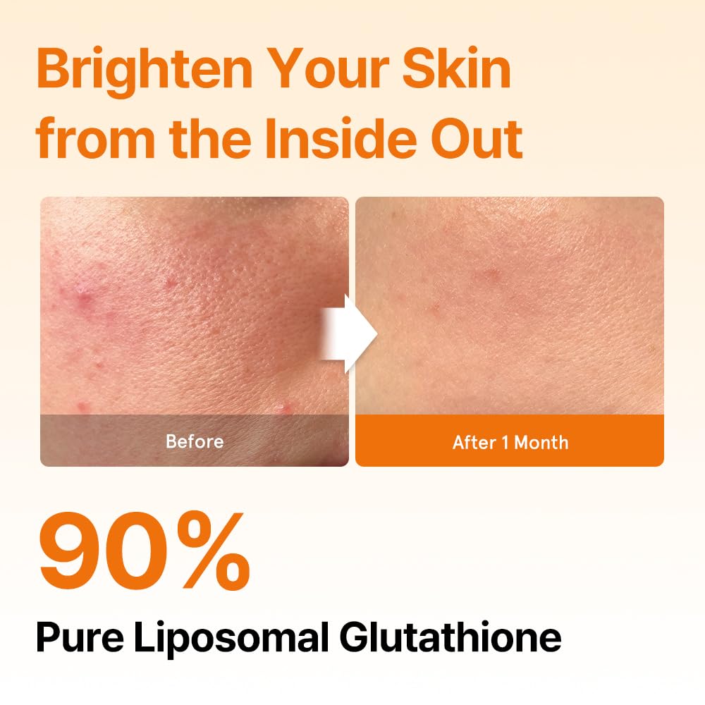 ESTHER FORMULA liposomal strip ingredients: glutathione, L-Cysteine, milk thistle.