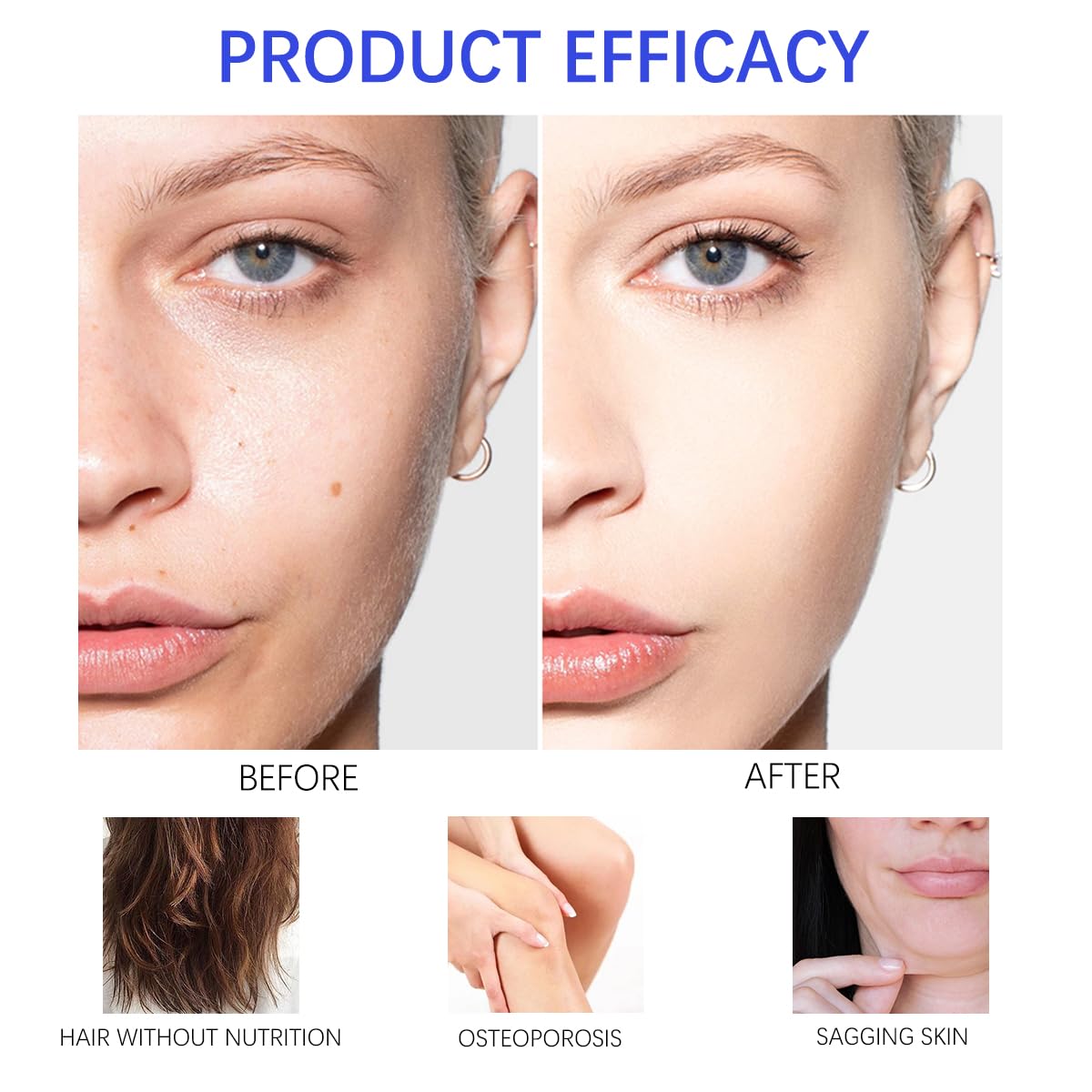 ESUNM Hyaluronic Acid Powder skin hydration close-up highlights plump, moisturized look.