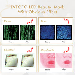 EVFOFO red light mask inner layer offers gentle contact and even illumination