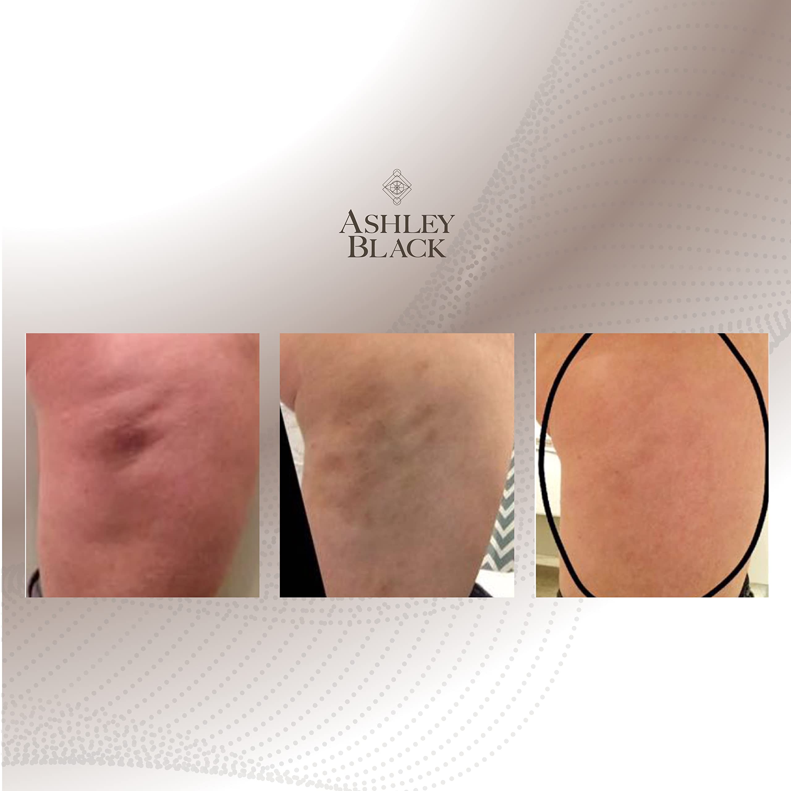 FasciaBlaster Nugget reachs tricky zones like inner thigh and neck with ease.