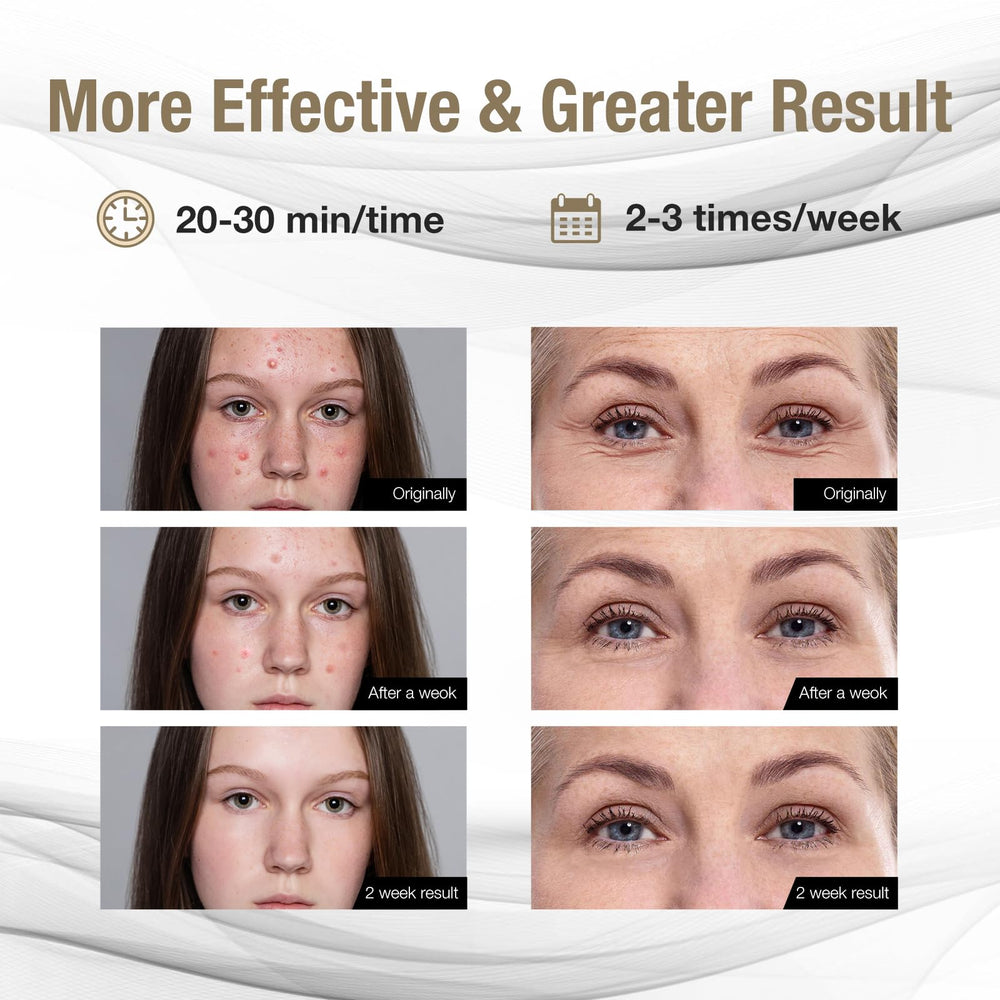 F FIWENE Pro-Grade FSA LED mask—on-face view demonstrates even light coverage for effective sessions.
