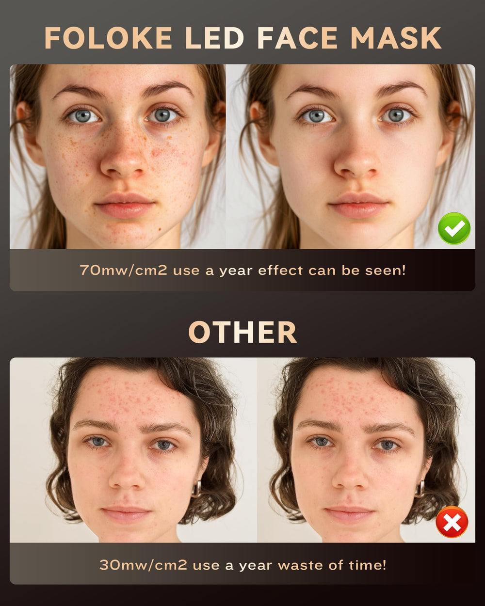 FOLOKE LED layers deliver even illumination across the face.