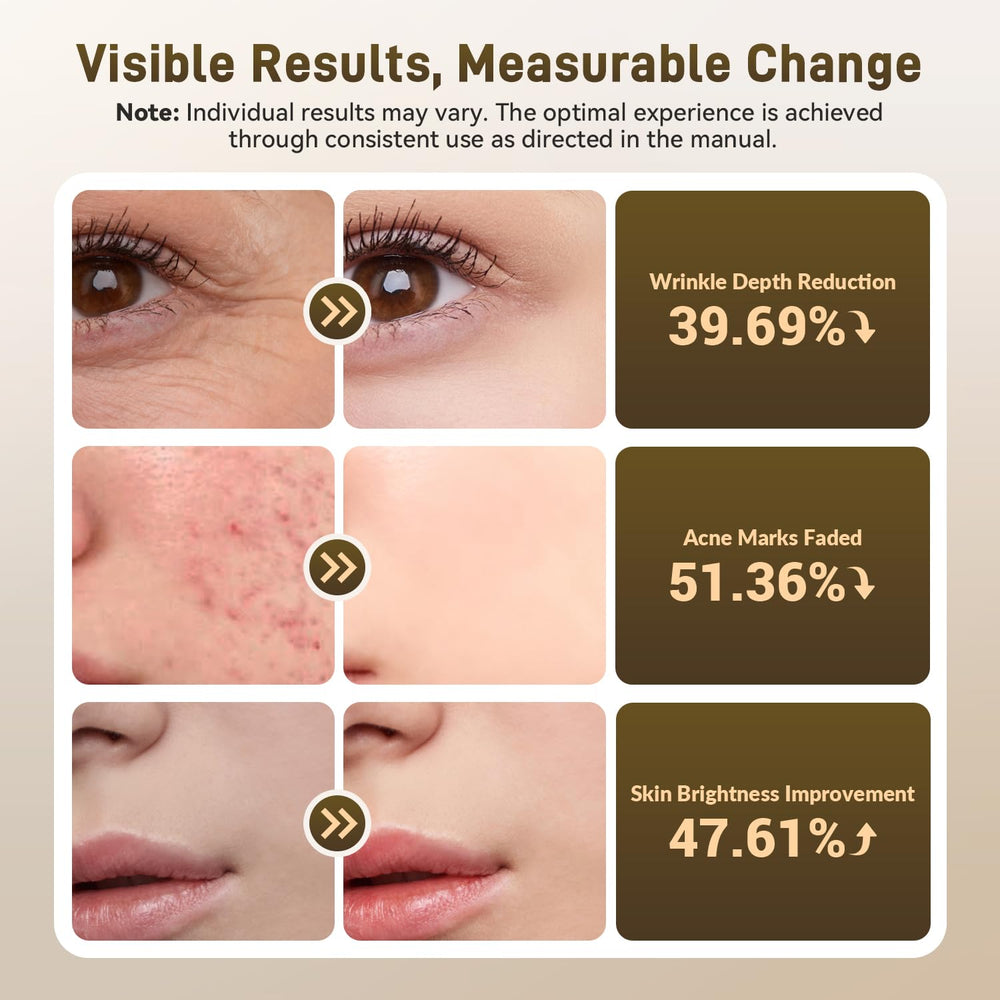 Gracekey four modes with 850nm NIR for versatile skincare routines