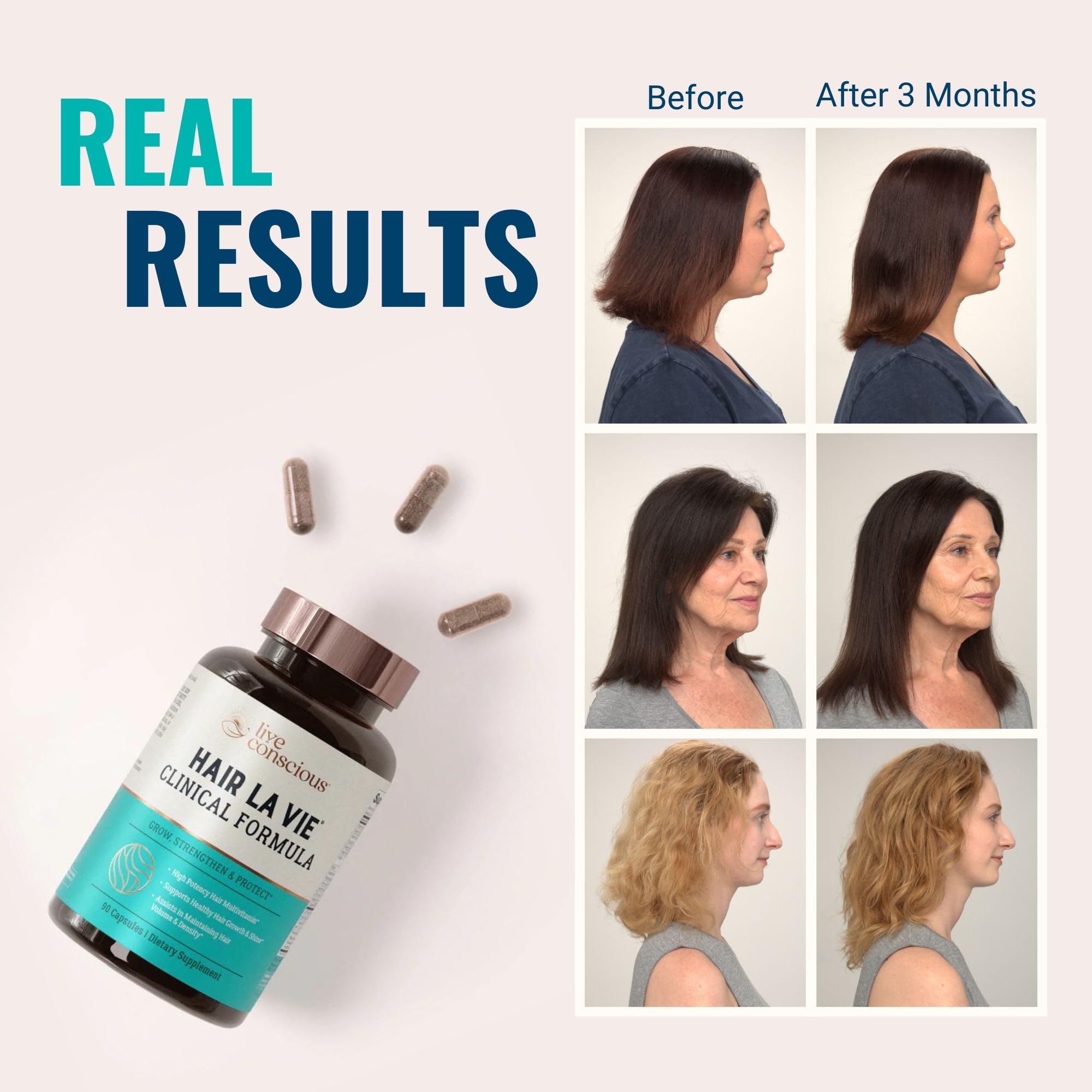 Hair La Vie Clinical Formula capsules in hand illustrating easy daily supplementation.