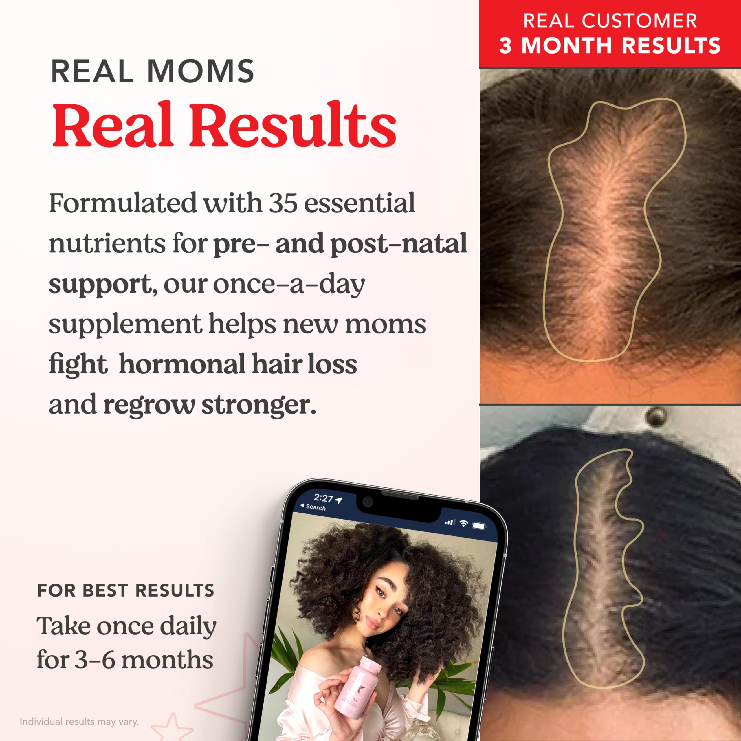 HAIRtamin MOM daily pill arrangement for convenient one-a-day pregnancy nutrition.