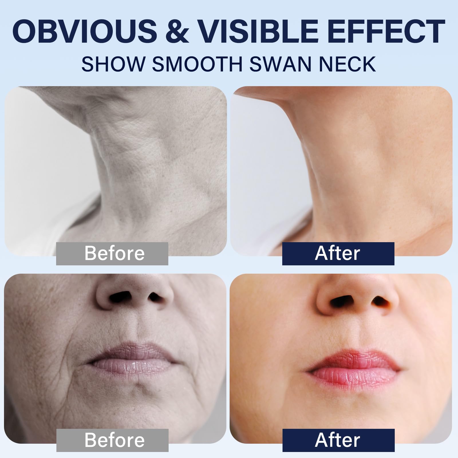 HANASCAR infusion mode supports serum absorption for better application